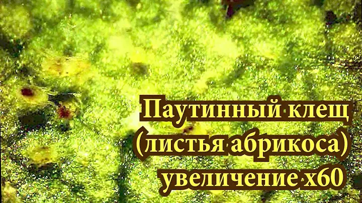Паутинный клещ под микроскопом.